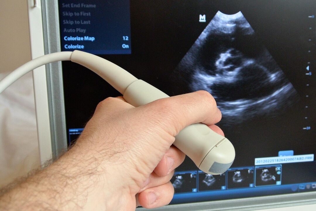 Ultrasound will help diagnose congestive prostatitis in a man. 
