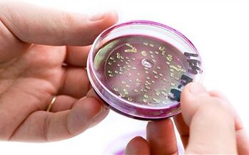 Bacteria in prostate secretion.